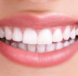 Beautiful White Teeth