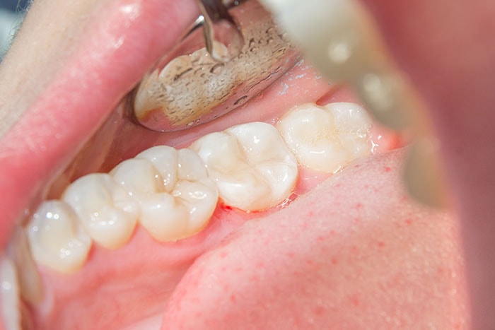 Cosmetic-Dentistry-2